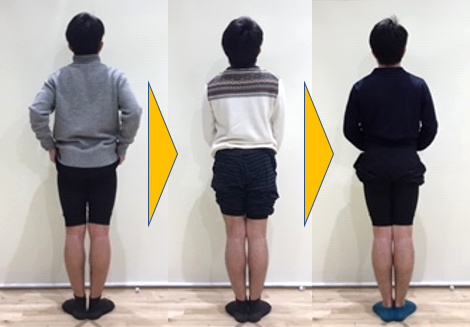 施術のビフォーアフター