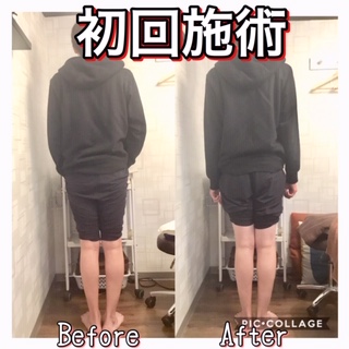 before画像