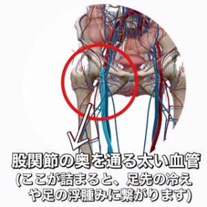 鼠径部血管のつまり